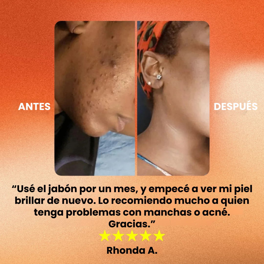 Exfoliado Facial + Jabón de Cúrcuma