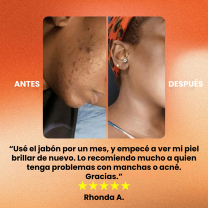 Exfoliado Facial + Jabón de Cúrcuma